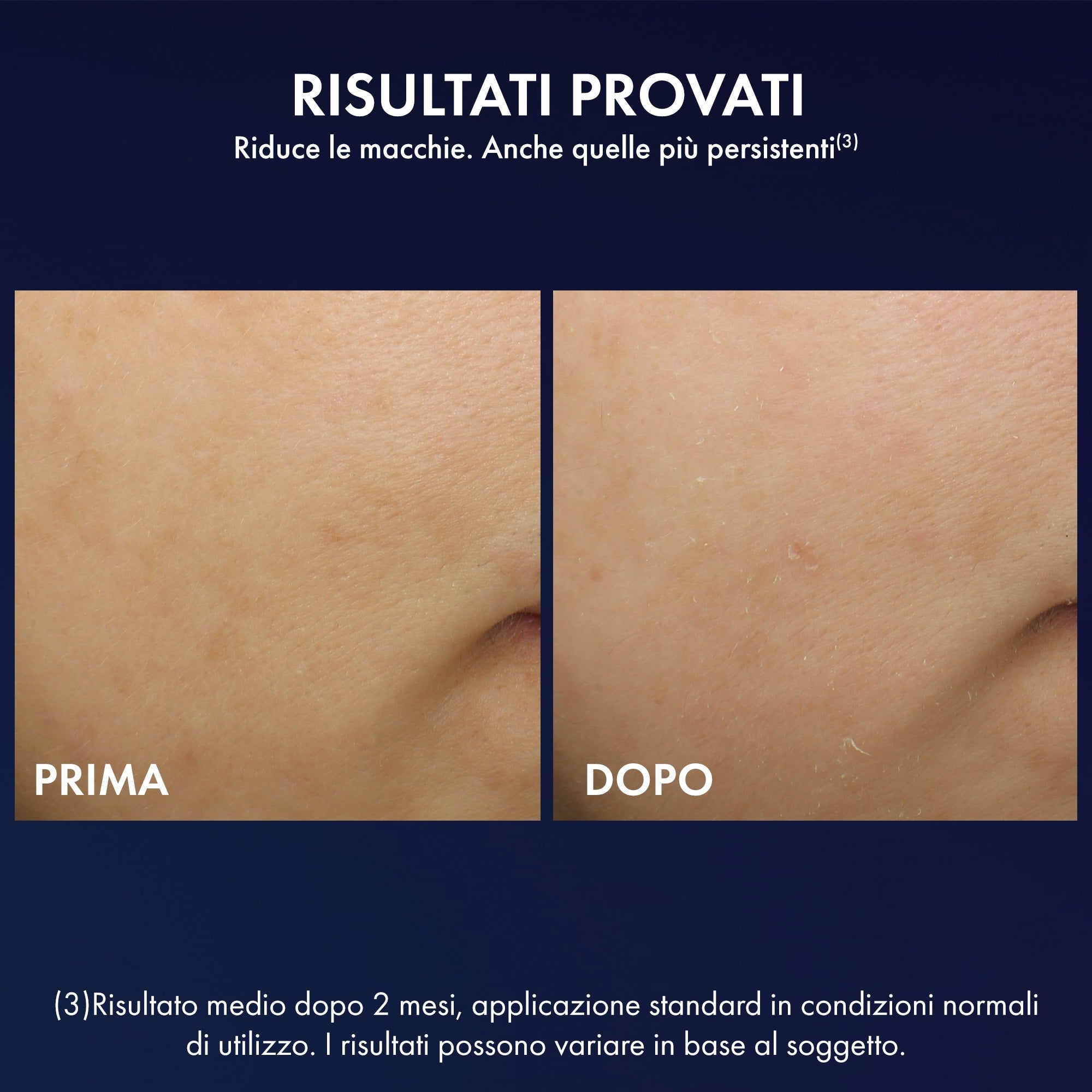 Liftactiv B3 Crema Notte con Retinolo - 1VH0000000198-3337875873086_03