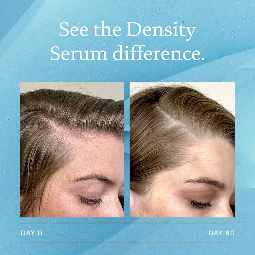 Scalp Care Density Serum - 2LP0000000072-840216934771_07